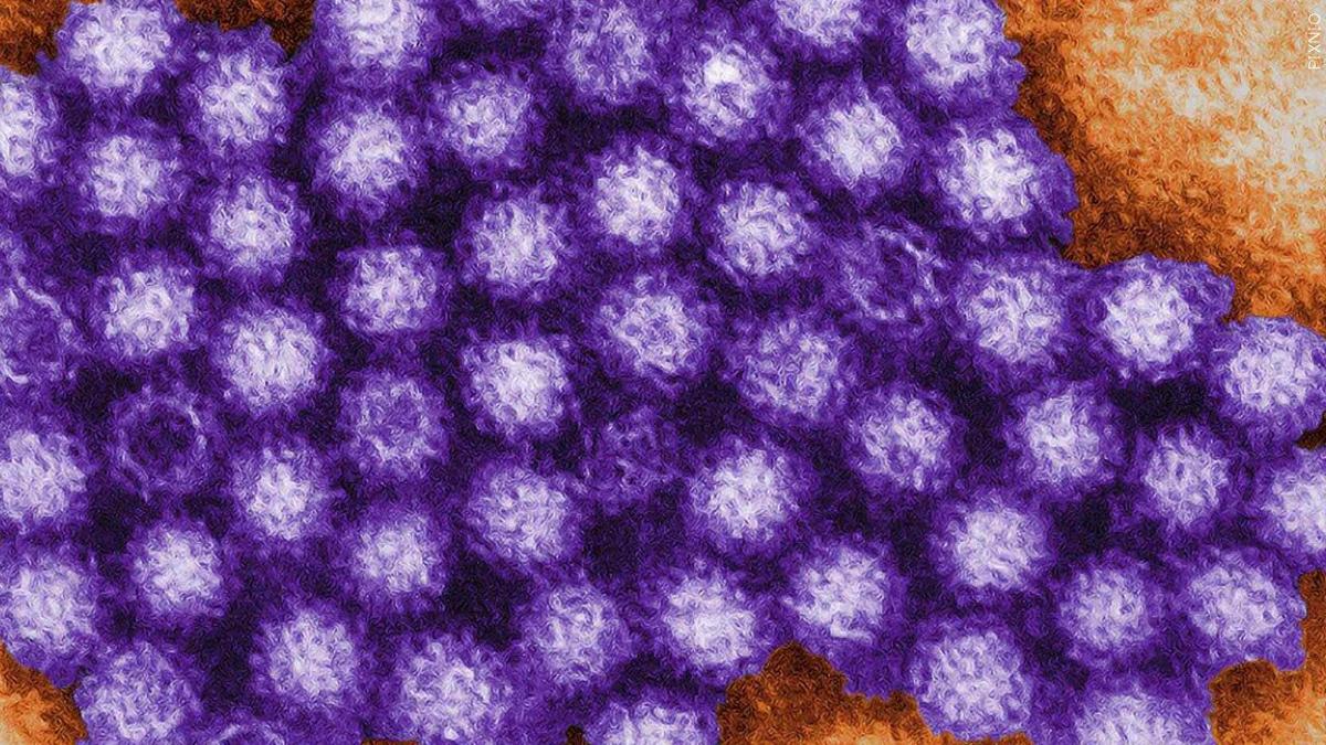 Norovirus on the Rise: Essential Information You Should Know