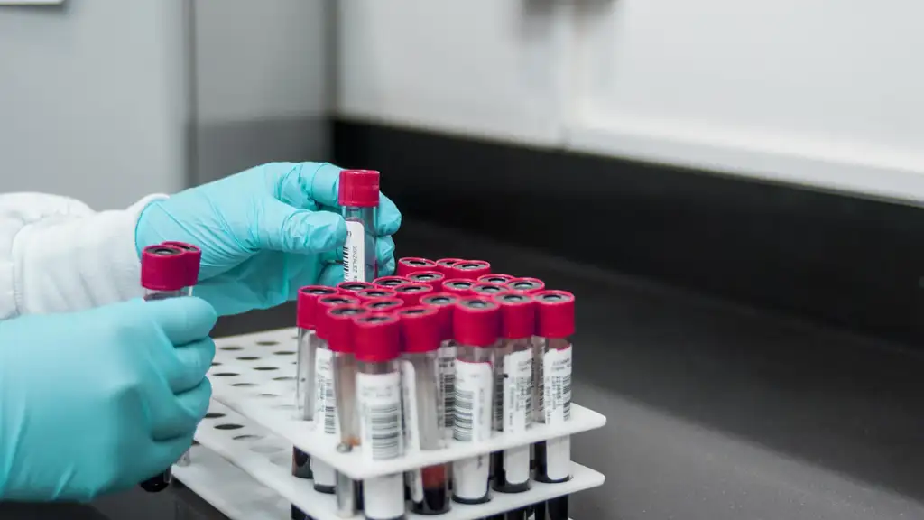 A new blood test for colon cancer did a good job in a study, giving more choices for screening